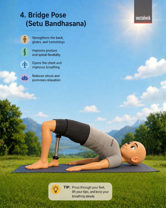 Amputee with prosthetic limb doing Bridge Pose (Setu Bandhasana) yoga on a mat, lifting hips to strengthen back and glutes